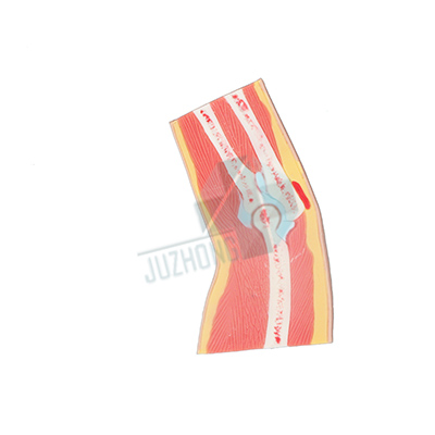 肘關(guān)節(jié)切面模型
