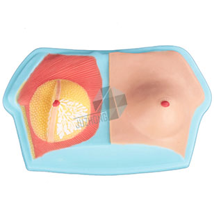 女性乳房解剖模型（雙側(cè)）